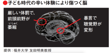 sub-buzz-27221-1495093618-1.pngのサムネイル画像